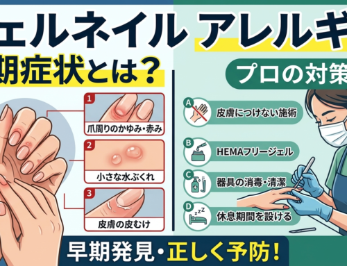 ジェルネイル アレルギーの初期症状とは？見分け方とプロの対策
