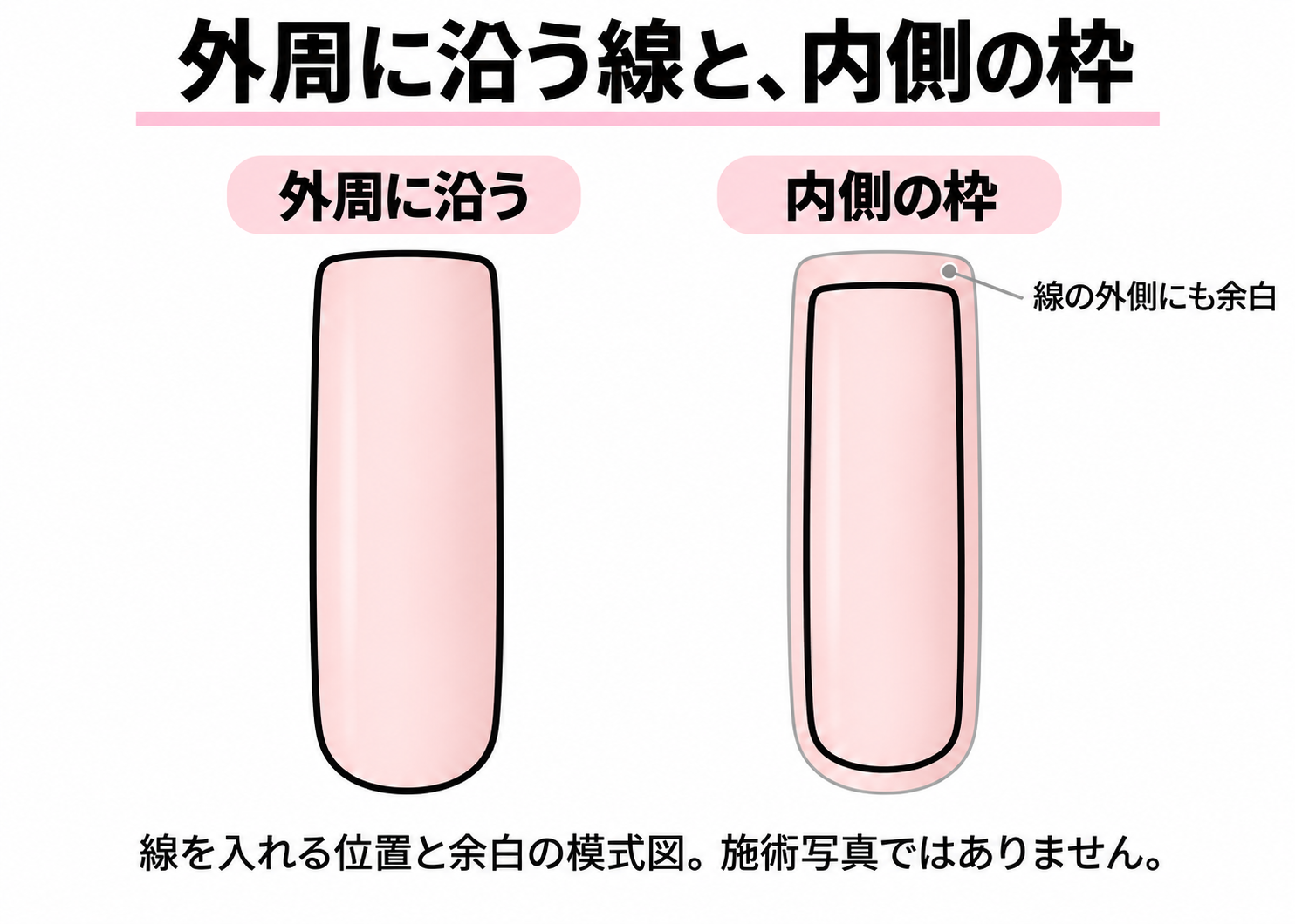 外周に沿う囲みと、線の外側にもベース色を残す内側枠の比較