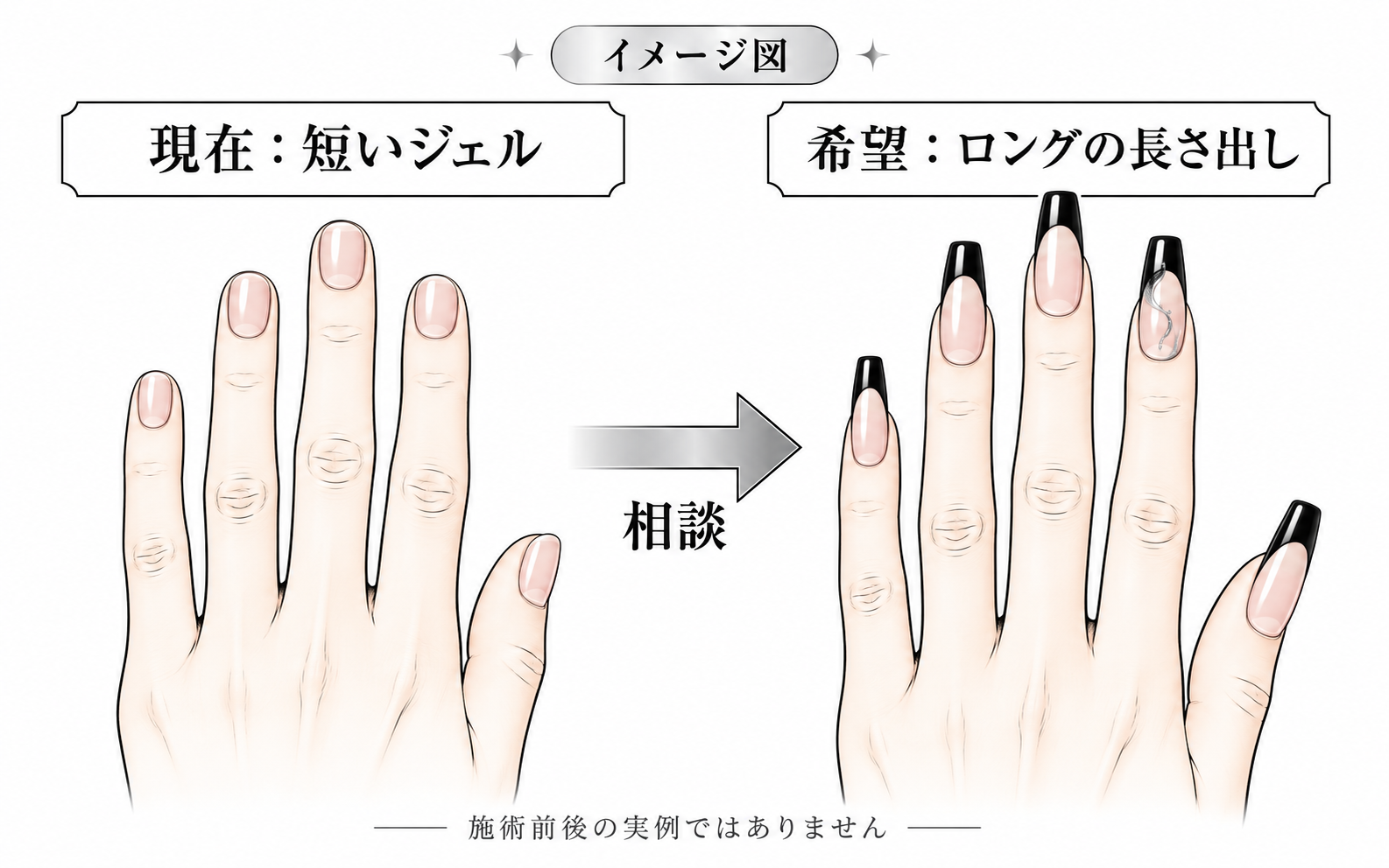 短いジェルからロングの長さ出しへ切り替える際に、現在と希望を分けて整理するイメージ